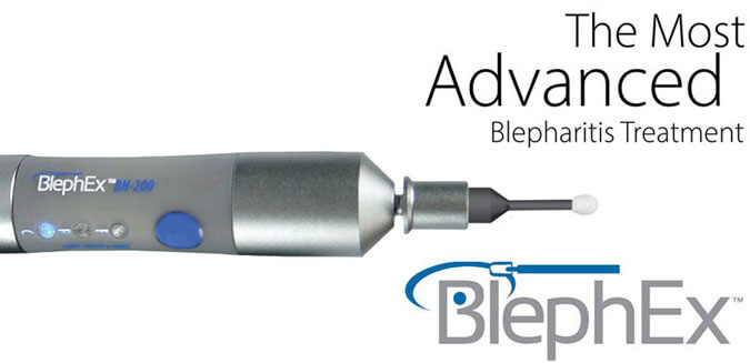 BlephEx for Blepharitis Treatment