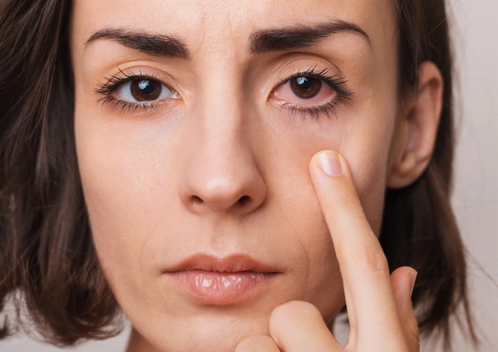 A patient is pointing to her left eye